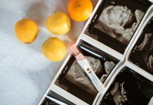 God meets at level of expectancy